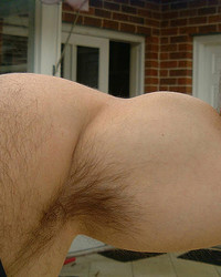 photo-thumb
