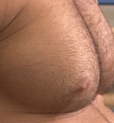 photo-thumb