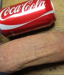 photo-thumb