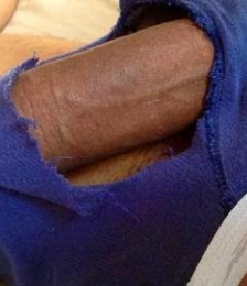 photo-thumb