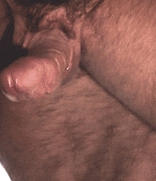 album-cover