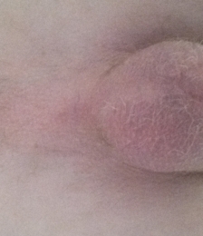 photo-thumb
