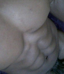 photo-thumb