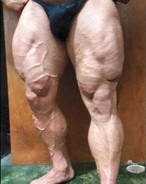 photo-thumb