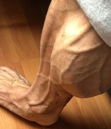photo-thumb