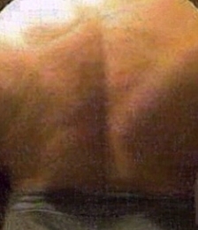 album-cover