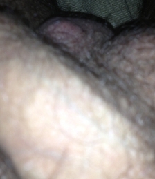 photo-thumb