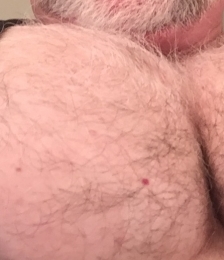 photo-thumb