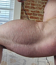 photo-thumb