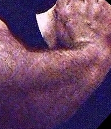 album-cover