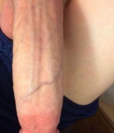 photo-thumb