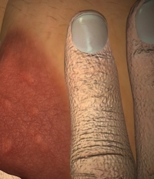photo-thumb