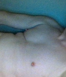 photo-thumb