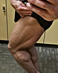 photo-thumb