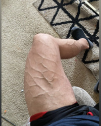photo-thumb