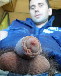 photo-thumb