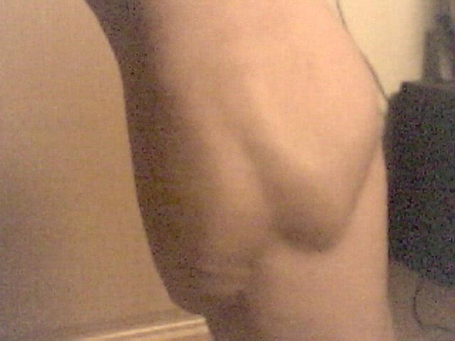 My calf