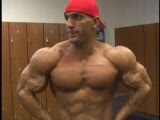 Armon Adibi 11 weeks out