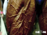 Jose Raymond  Vasc Legs