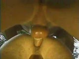 Thumb 6
