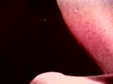 Thumb 7