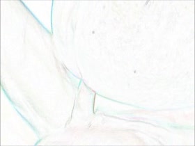 Thumb 13