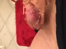 Thumb 8