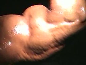 Thumb 11