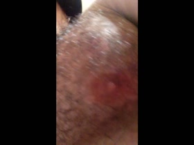 Thumb 18