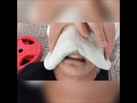 Thumb 8