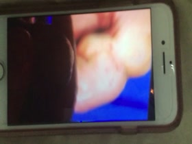 Thumb 12