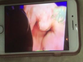 Thumb 13
