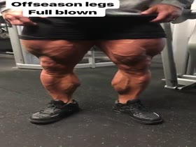 Legs