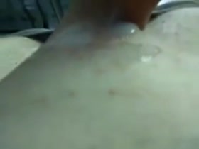 Thumb 17
