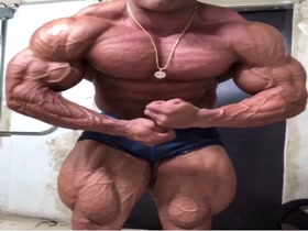Vascular Monster