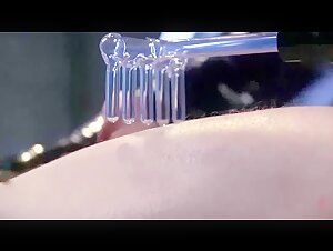Thumb 6